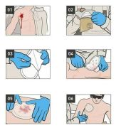 Opatrunek wentylowany okluzyjny - ACS