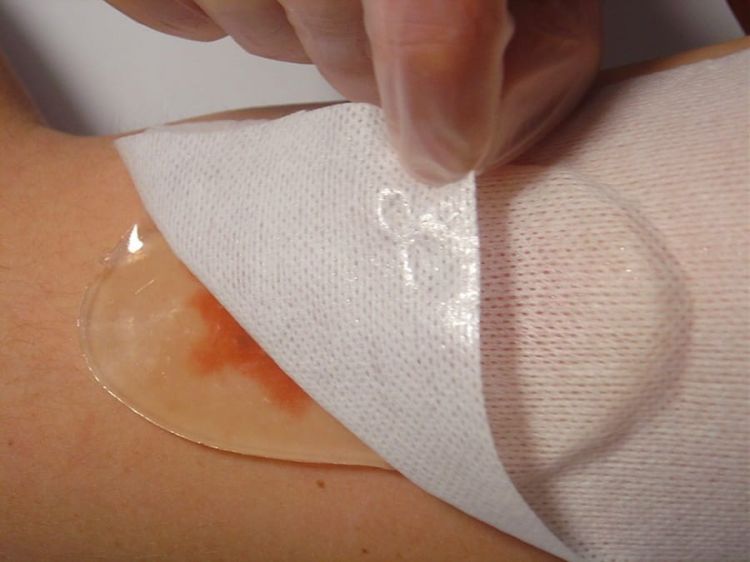 Opatrunek hydrożelowy Kikgel Aquagel krążek Ø 5 cm